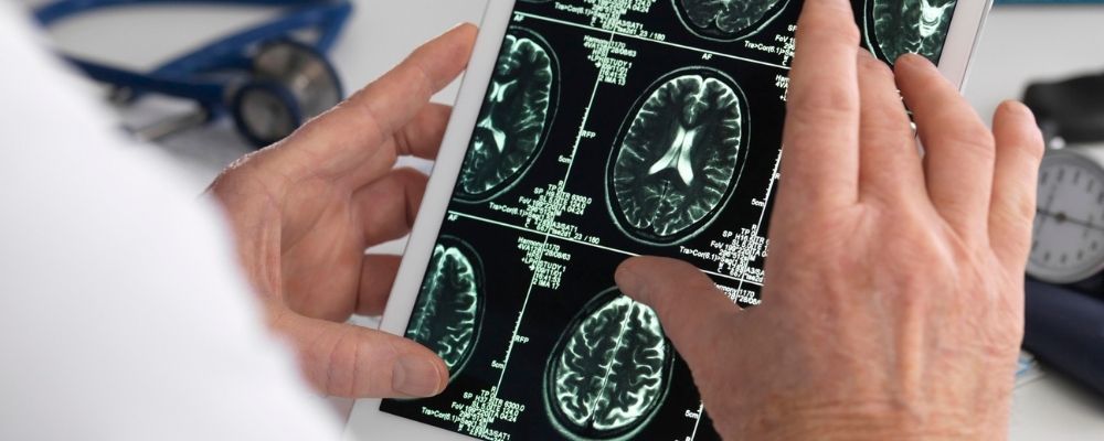 Dokter houdt een print van een hersenscan vast